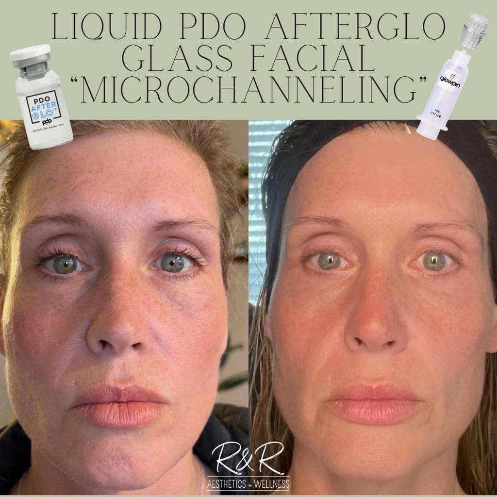 Before and after shot